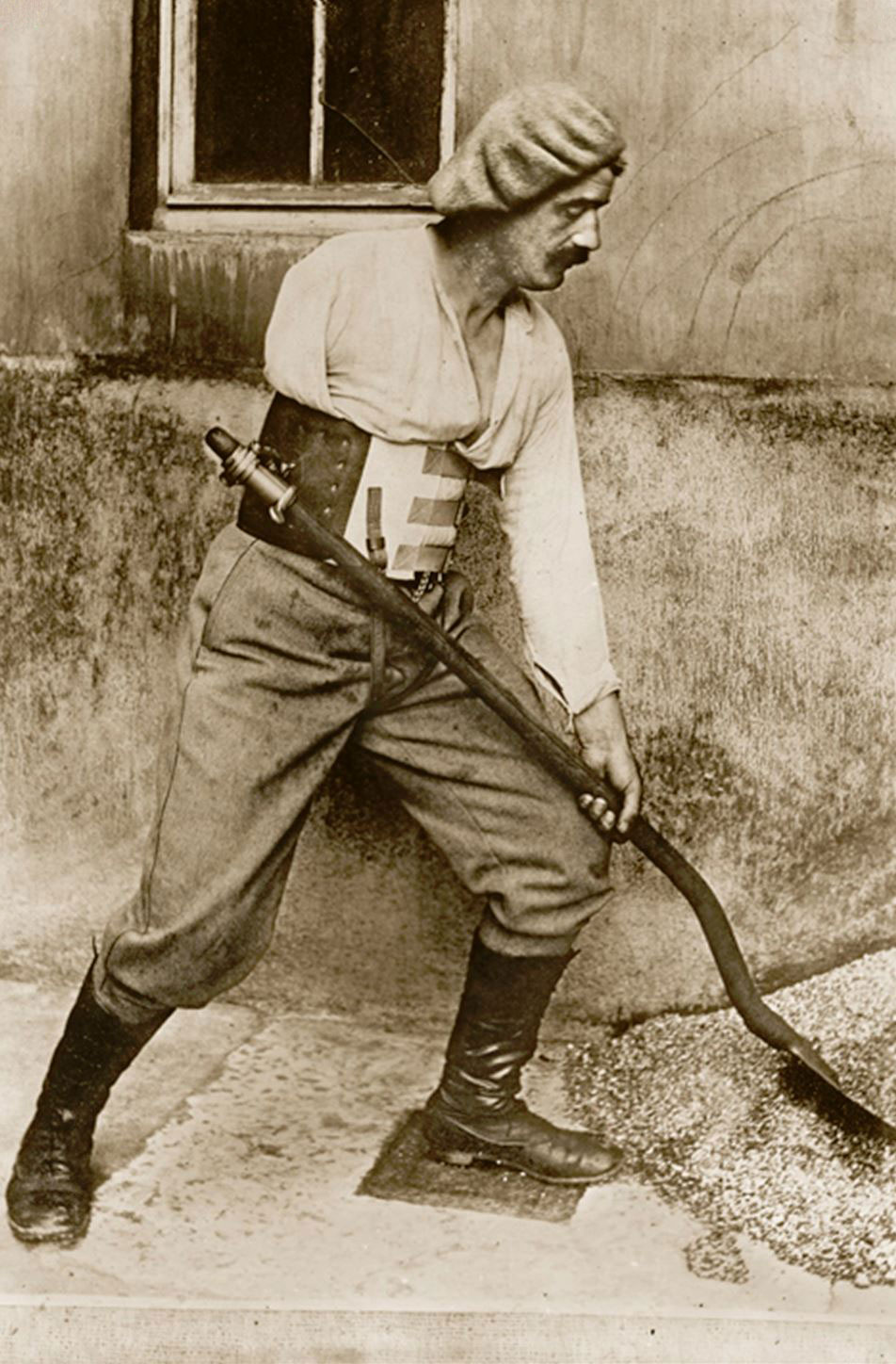 WWI Amputee Fitted with a Shovel Belt